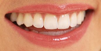 Image of a smile showing healthy gums